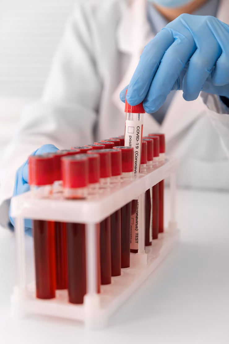 mobile-phlebotomy-services-1